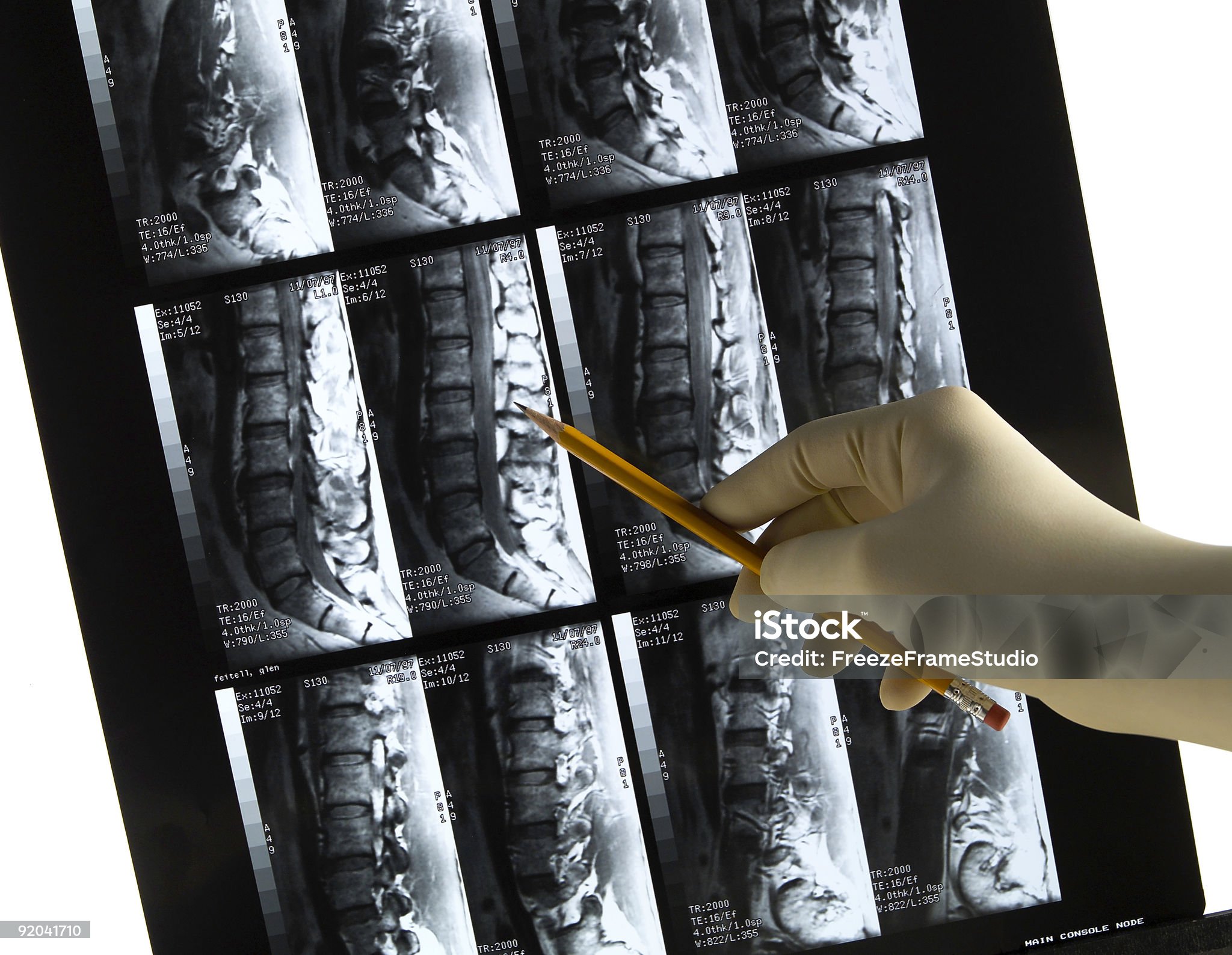 istockphoto-92041710-2048x2048